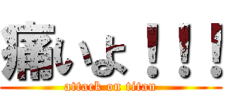 痛いよ！！！ (attack on titan)