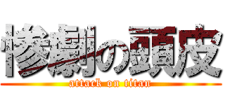 惨劇の頭皮 (attack on titan)