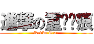 進撃の重溫疤痕 (Relive Scar)