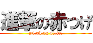 進撃の赤つげ (attack on utaite)