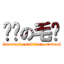 变态の毛线 (Abnormal condition of wool )