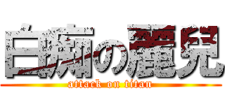 白痴の麗兒 (attack on titan)