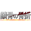 鎖骨の骨折 (Be careful of falling)