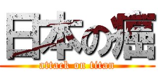 日本の癌 (attack on titan)