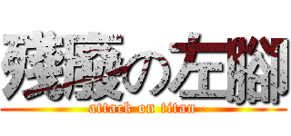 殘廢の左腳 (attack on titan)