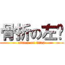 骨折の左腳 (attack on titan)