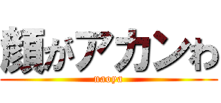 顔がアカンわ (naoya)