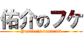 佑介のフケ (Yusuke's dandruff)