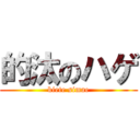 的汰のハゲ (kiete simae)