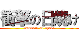 衝撃の日焼け (sunburn of shock)