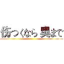伤つくなら 奥まで ()