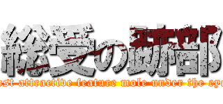 総受の跡部 (most attractive feature mole under the eye )