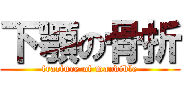 下顎の骨折 (fracture of mandible)