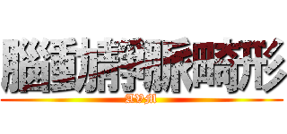 腦動靜脈畸形 (AVM)