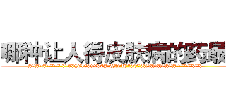 哪种让人得皮肤病的药最好 (哪种让人得皮肤病的药最好【电.话186x0156x9662-Q194843976林氏药业】我们做的是长期生意,靠的是老客户长期支持
参考消息网2月20日报道 韩媒称，“剩女多、离婚率高的城市，房价一定会上涨。”这是中国经济学家金岩石2016年12月参加在上海举行的房地产相关论坛时说的话。
)