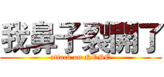 我鼻子裂開了 (attack on NOSE)
