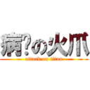 病娇の火爪 (attack on titan)