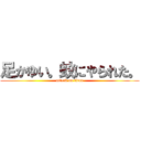 足かゆい。蚊にやられた。 (attack on titan)