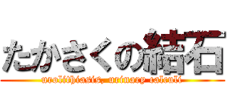 たかさくの結石 (urolithiasis, urinary calculi)