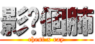 影您個肺 (chest x ray)