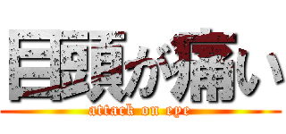 目頭が痛い (attack on eye)