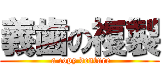 義歯の複製 ( a copy denture)