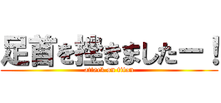 足首を挫きましたー！ (attack on titan)