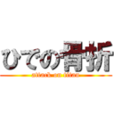 ひでの骨折 (attack on titan)