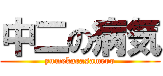 中二の病気 (yumekarasamero)