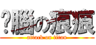 耍腦の痕痕 (attack on titan)
