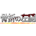 骨折の左腿 (attack on titan)