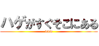 ハゲがすぐそこにある (www)