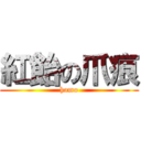 紅飴の爪痕 (homo)