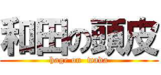 和田の頭皮 (hage on  wada)