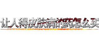 让人得皮肤病的药怎么买 (让人得皮肤病的药怎么买【电.话186x0156x9662-Q194843976林氏药业】我们做的是长期生意,靠的是老客户长期支持
参考消息网2月20日报道 韩媒称，“剩女多、离婚率高的城市，房价一定会上涨。”这是中国经济学家金岩石2016年12月参加在上海举行的房地产相关论坛时说的话。
)