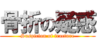 骨折の疑惑 (Suspicion of fracture)