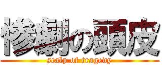 惨劇の頭皮 (scalp of tragedy)