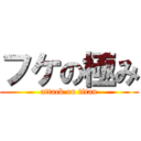 フケの極み (attack on titan)