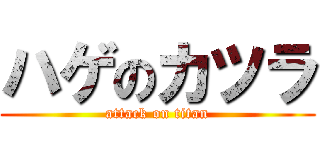 ハゲのカツラ (attack on titan)