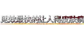 见效最快的让人得皮肤病的药 (见效最快的让人得皮肤病的药【电.话186x0156x9662-Q194843976林氏药业】我们做的是长期生意,靠的是老客户长期支持
参考消息网2月20日报道 韩媒称，“剩女多、离婚率高的城市，房价一定会上涨。”这是中国经济学家金岩石2016年12月参加在上海举行的房地产相关论坛时说的话。
)