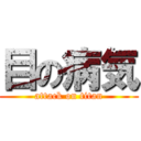 目の病気 (attack on titan)