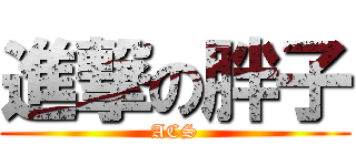 進撃の胖子 (ACS)