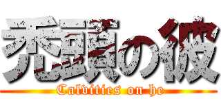 禿頭の彼 ( Calvities on he)