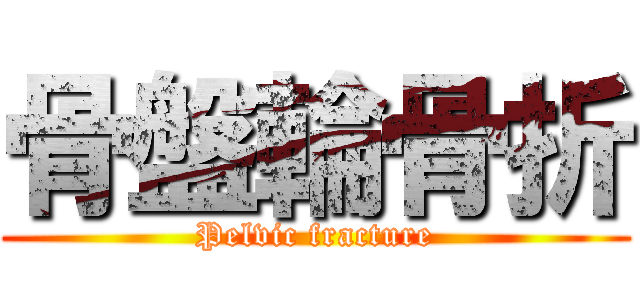 骨盤輪骨折 (Pelvic fracture)