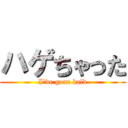 ハゲちゃった (I've gone bald)