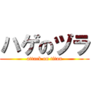 ハゲのヅラ (attack on titan)