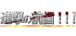 進撃の前歯！！！ (attack on titan)