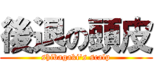 後退の頭皮 (shibagaki\'s scalp)