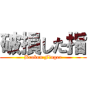 破損した指 (Broken Finger)