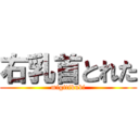 右乳首とれた (migitikubi)